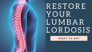 RESTORE Lumbar Lordosis amp The Curvature Of The Spine With These Exercises How To Demo [upl. by Corwun]