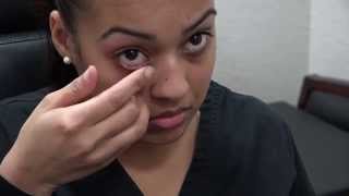 How to Apply Ointment to the Eyes and Eyelids [upl. by Sykleb]