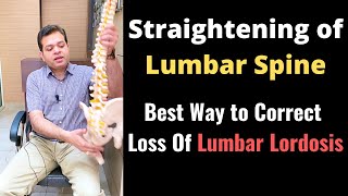 Straightening of Lumbar Spine Loss of Lumbar Lordosis Treatment How to Correct Lumbar Curvature [upl. by Wat]