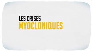 Les crises myocloniques [upl. by Novit]