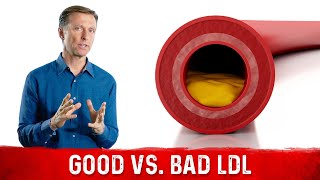 You Have Good and Bad LDL lowdensity lipoprotein [upl. by Siwel]