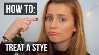 How to Treat a Stye in Your Eye QUICKLY  Ellesse [upl. by Annoit]