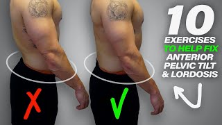 10 Exercises to Help Fix Anterior Pelvic Tilt amp Lordosis [upl. by Aztinaj828]