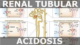 Renal Tubular Acidosis [upl. by Aniehs]