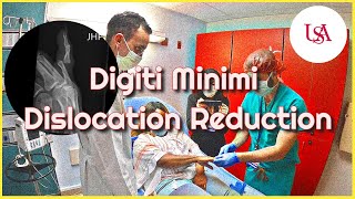 Digiti Minimi Dislocation Emergency [upl. by Ley]