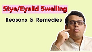 Stye  Eyelid Swellings  Reasons amp Remedies [upl. by Mona]