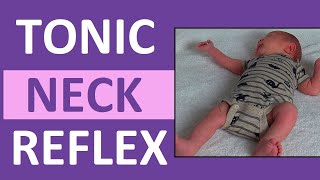 Tonic Neck Reflex in Infant Newborn  Pediatric Nursing Newborn Assessment [upl. by Piotr]