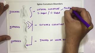 Spine Curvature Disorders  Scoliosis Kyphosis Lordosis [upl. by Renee]