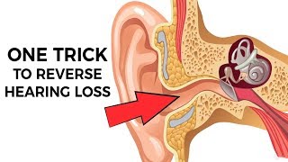 1 Trick To Reverse Hearing Loss Do This Tonight [upl. by Haleemak344]