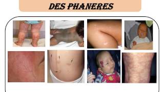 PEDIATRIE Examen clinique du nourrisson [upl. by Kerk]