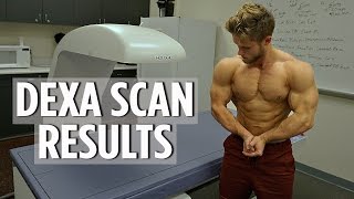 Whats My Bodyfat Percentage  POSING Update  Training Cues to Target Lats [upl. by Romo]