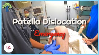 Patella Dislocation Emergency [upl. by Yonina]