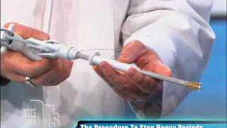 Novasure Procedure Performed on The Doctors [upl. by Onitnatsnoc]