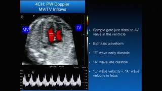 Basic Fetal Echocardiography [upl. by Atiluj]