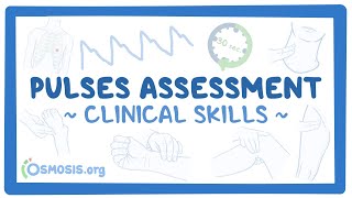 Clinical Skills Pulses assessment [upl. by Ayikin292]