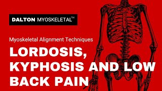 Lordosis Kyphosis and Low Back Pain [upl. by Rodablas]