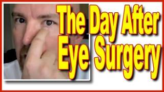 Surviving Eye Surgery  The Day After Chalazion Part 2 [upl. by Aicilaf]