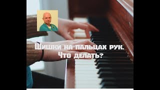 Шишки на пальцах рук Что делатьшишкинапальцах [upl. by Yellek]