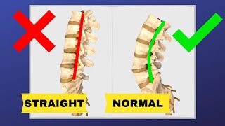 How To Correct Straightening Of Lumbar Spine FIX LOSS OF LUMBAR LORDOSIS  Dr Walter Salubro [upl. by Adniralc]